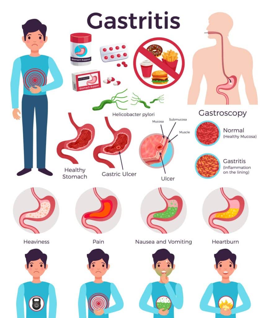 can alcoholic gastritis kill you - Alt Text